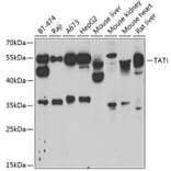 Western Blot - Anti-ATTY Antibody (A9991) - Antibodies.com