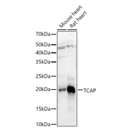 Western Blot - Anti-Telethonin Antibody (A9992) - Antibodies.com