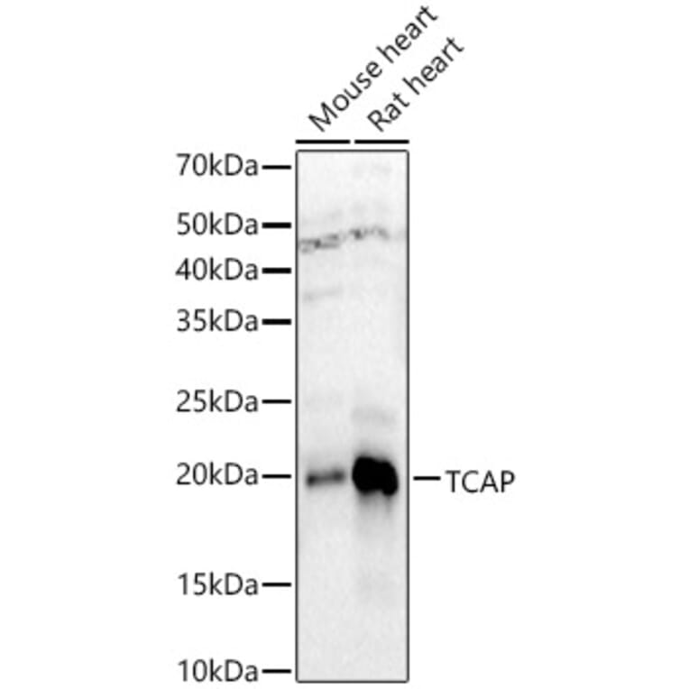 Western Blot - Anti-Telethonin Antibody (A9992) - Antibodies.com