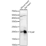 Western Blot - Anti-Telethonin Antibody (A9992) - Antibodies.com