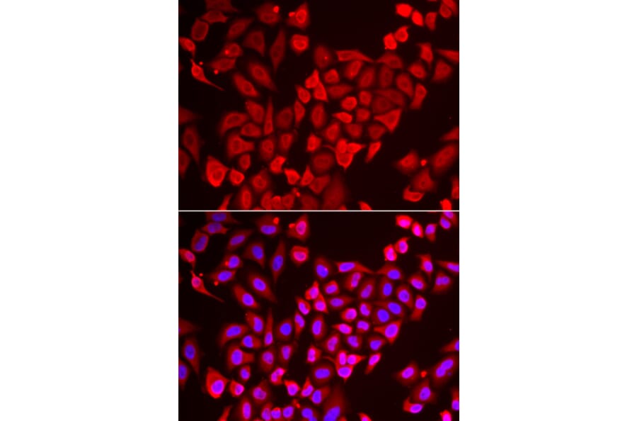 Immunofluorescence - Anti-TNP2 Antibody (A6773) - Antibodies.com