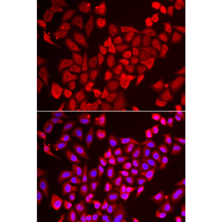 Immunofluorescence - Anti-TNP2 Antibody (A6773) - Antibodies.com