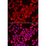Immunofluorescence - Anti-TNP2 Antibody (A6773) - Antibodies.com