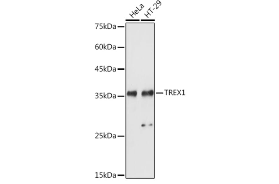 Western Blot - Anti-TREX1 Antibody (A9994) - Antibodies.com