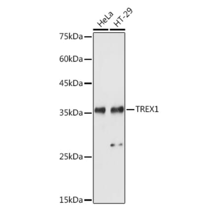 Western Blot - Anti-TREX1 Antibody (A9994) - Antibodies.com