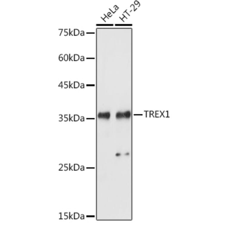 Western Blot - Anti-TREX1 Antibody (A9994) - Antibodies.com