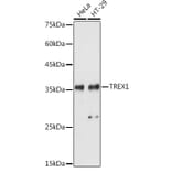 Western Blot - Anti-TREX1 Antibody (A9994) - Antibodies.com