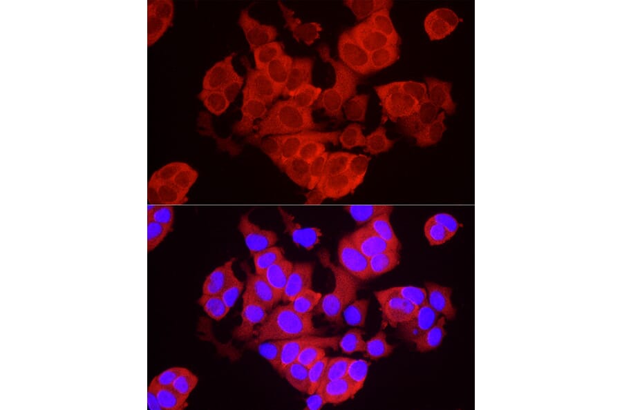 Immunofluorescence - Anti-TREX1 Antibody (A9994) - Antibodies.com