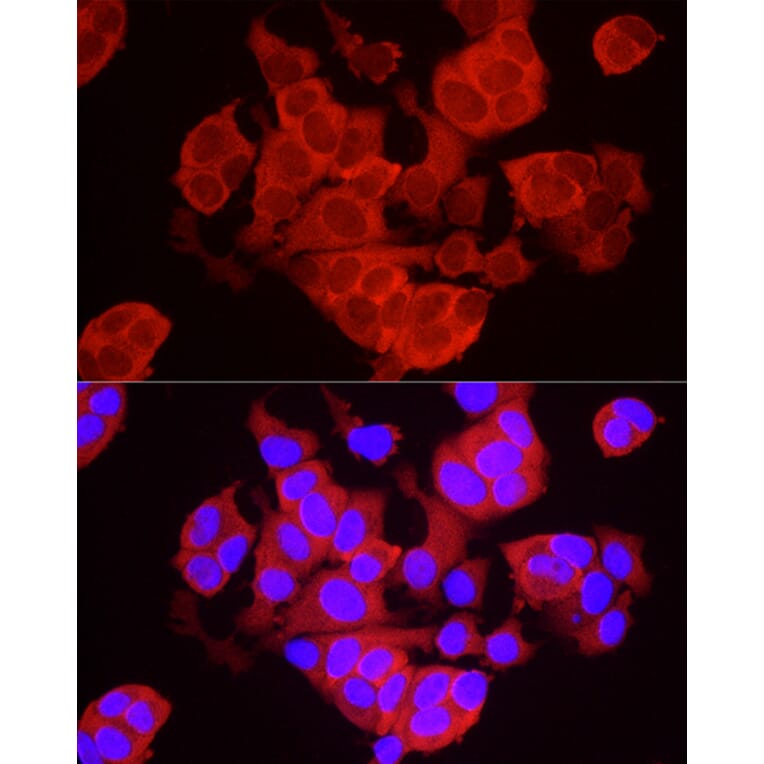 Immunofluorescence - Anti-TREX1 Antibody (A9994) - Antibodies.com