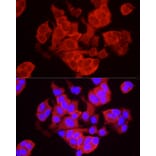 Immunofluorescence - Anti-TREX1 Antibody (A9994) - Antibodies.com
