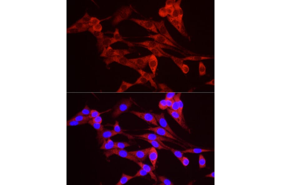 Immunofluorescence - Anti-TREX1 Antibody (A9994) - Antibodies.com
