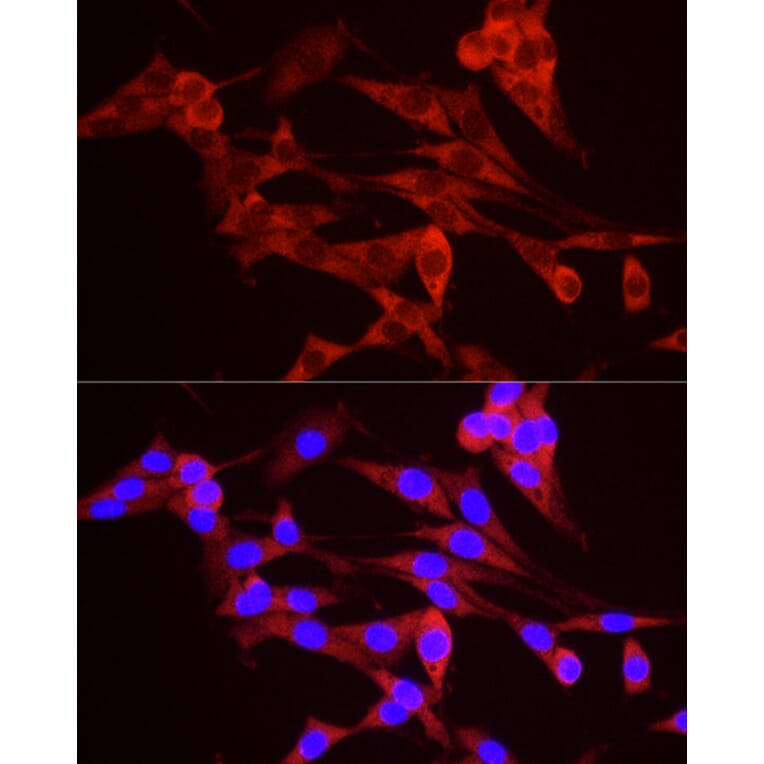 Immunofluorescence - Anti-TREX1 Antibody (A9994) - Antibodies.com