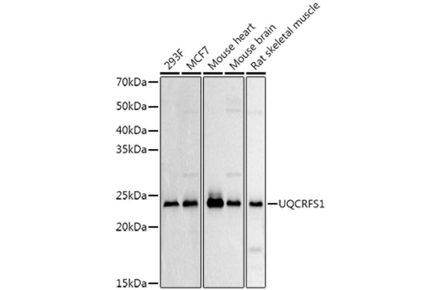 Western Blot - Anti-UQCRFS1/RISP Antibody (A9995) - Antibodies.com