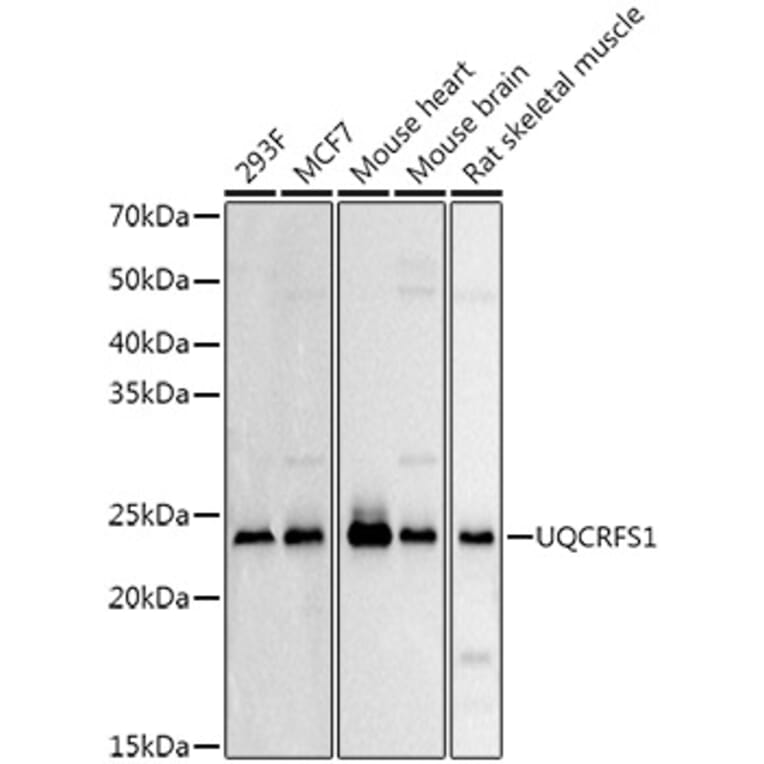 Western Blot - Anti-UQCRFS1/RISP Antibody (A9995) - Antibodies.com