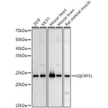 Western Blot - Anti-UQCRFS1/RISP Antibody (A9995) - Antibodies.com