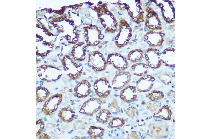 Immunohistochemistry - Anti-UQCRFS1/RISP Antibody (A9995) - Antibodies.com