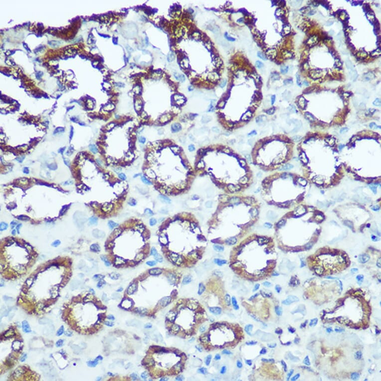 Immunohistochemistry - Anti-UQCRFS1/RISP Antibody (A9995) - Antibodies.com