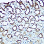 Immunohistochemistry - Anti-UQCRFS1/RISP Antibody (A9995) - Antibodies.com