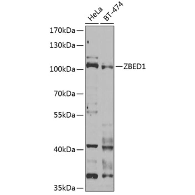 Western Blot - Anti-DREF Antibody (A9996) - Antibodies.com