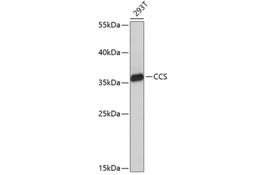 Western Blot - Anti-Superoxide Dismutase 4/CCS Antibody (A9998) - Antibodies.com