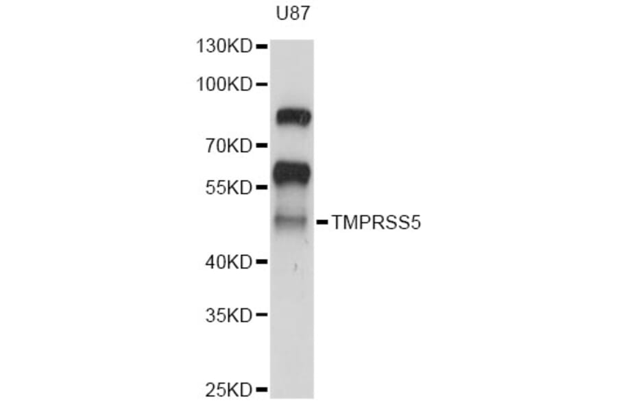 Western Blot - Anti-TMPRSS5 Antibody (A14307) - Antibodies.com