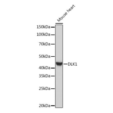 Western Blot - Anti-DLK-1 Antibody (A90001) - Antibodies.com