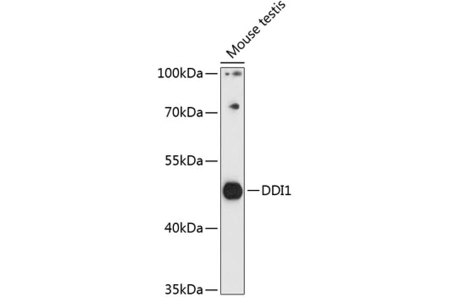 Western Blot - Anti-DDI1 Antibody (A90002) - Antibodies.com
