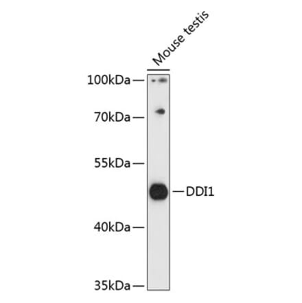 Western Blot - Anti-DDI1 Antibody (A90002) - Antibodies.com
