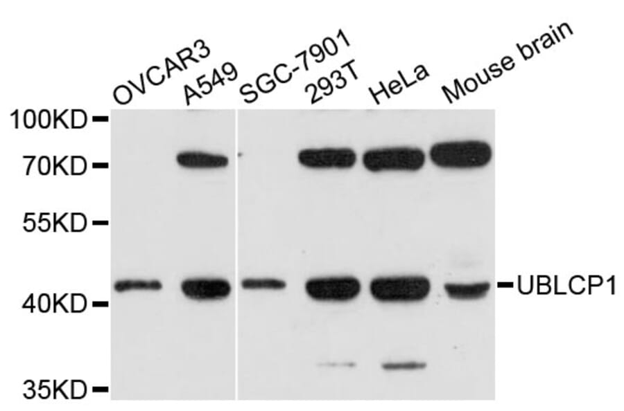 Western Blot - Anti-UBLCP1 Antibody (A13729) - Antibodies.com