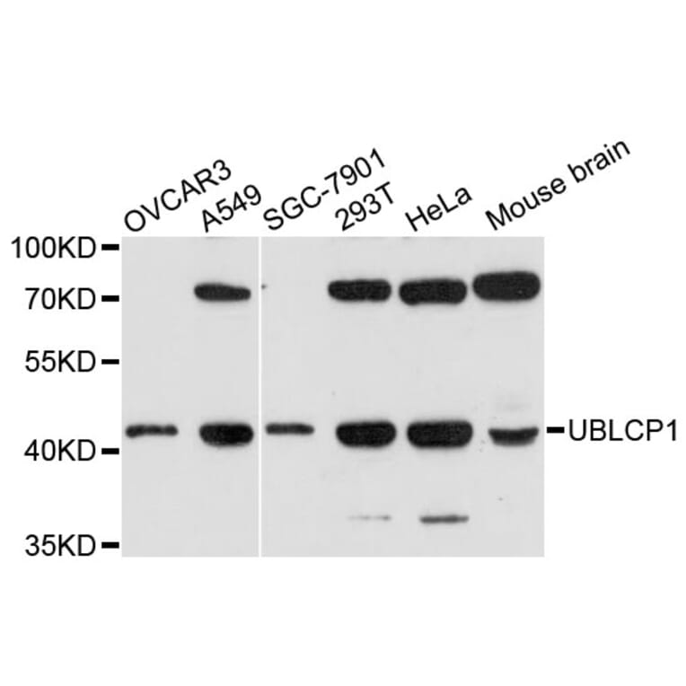 Western Blot - Anti-UBLCP1 Antibody (A13729) - Antibodies.com