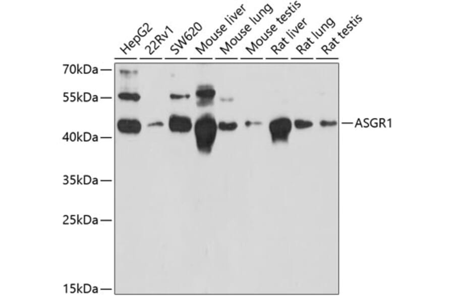 Western Blot - Anti-Asialoglycoprotein Receptor 1/HL-1 Antibody (A90004) - Antibodies.com