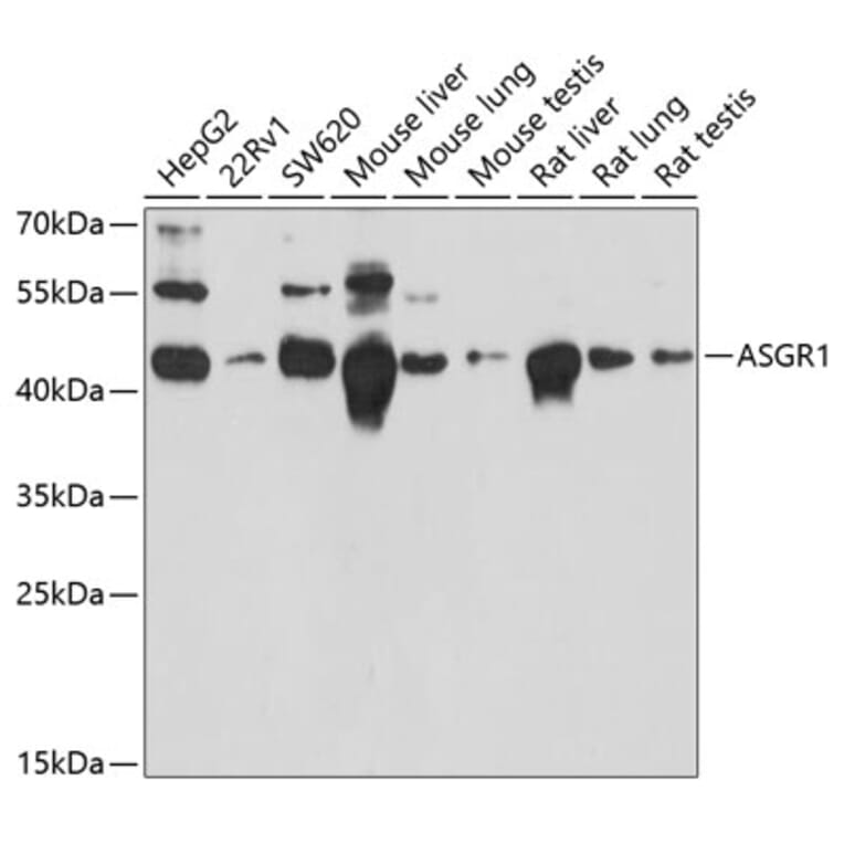 Western Blot - Anti-Asialoglycoprotein Receptor 1/HL-1 Antibody (A90004) - Antibodies.com