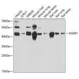 Western Blot - Anti-Asialoglycoprotein Receptor 1/HL-1 Antibody (A90004) - Antibodies.com