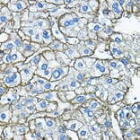 Immunohistochemistry - Anti-Asialoglycoprotein Receptor 1/HL-1 Antibody (A90004) - Antibodies.com