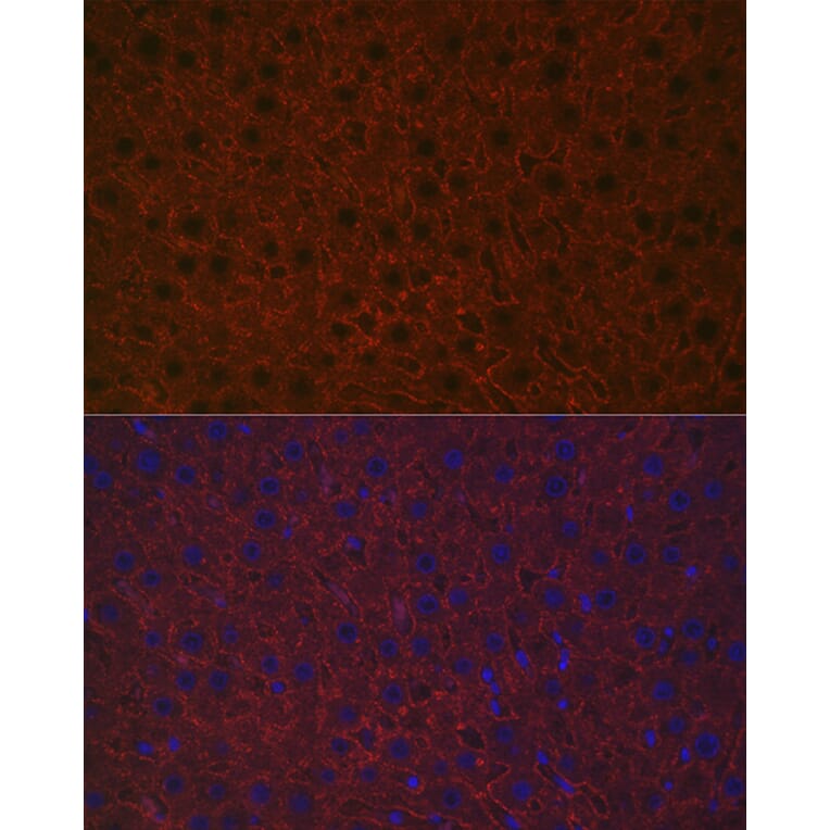 Immunofluorescence - Anti-Asialoglycoprotein Receptor 1/HL-1 Antibody (A90004) - Antibodies.com