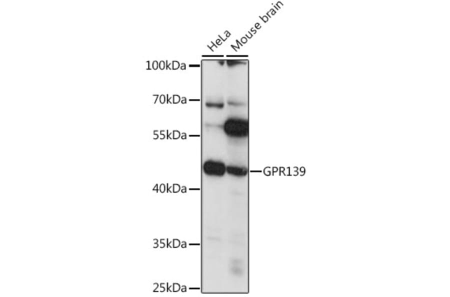 Western Blot - Anti-GPR 139 Antibody (A90005) - Antibodies.com