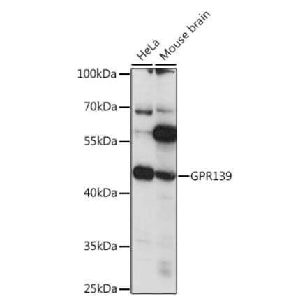 Western Blot - Anti-GPR 139 Antibody (A90005) - Antibodies.com