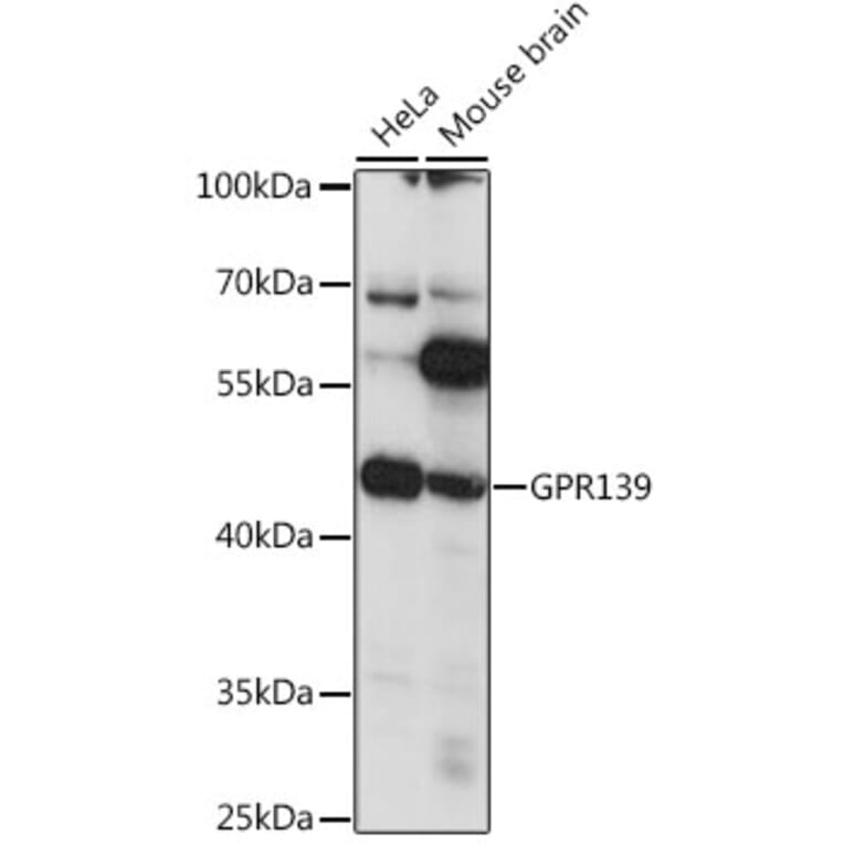Western Blot - Anti-GPR 139 Antibody (A90005) - Antibodies.com