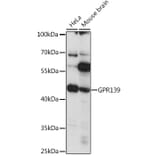 Western Blot - Anti-GPR 139 Antibody (A90005) - Antibodies.com