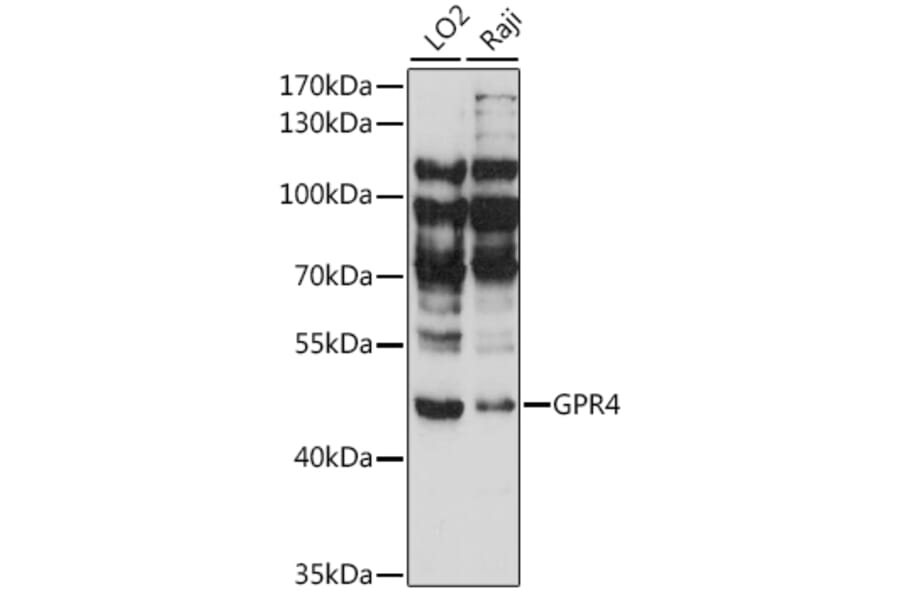 Western Blot - Anti-GPCR GPR4 Antibody (A90006) - Antibodies.com