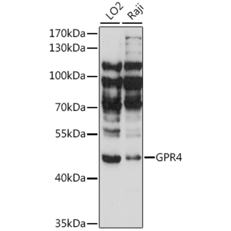 Western Blot - Anti-GPCR GPR4 Antibody (A90006) - Antibodies.com