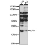Western Blot - Anti-GPCR GPR4 Antibody (A90006) - Antibodies.com