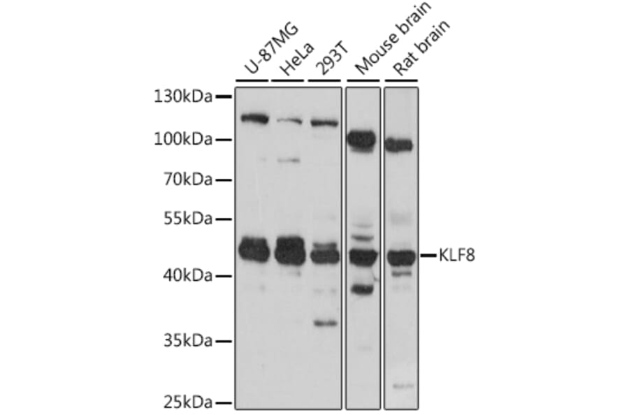 Western Blot - Anti-KLF8 Antibody (A90007) - Antibodies.com