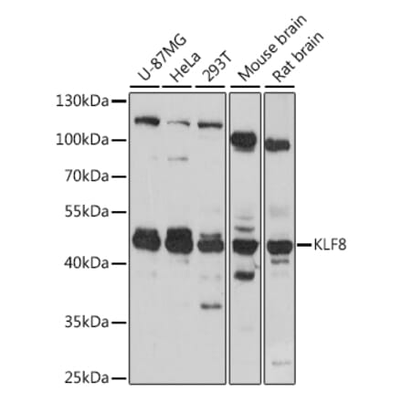 Western Blot - Anti-KLF8 Antibody (A90007) - Antibodies.com