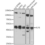 Western Blot - Anti-KLF8 Antibody (A90007) - Antibodies.com