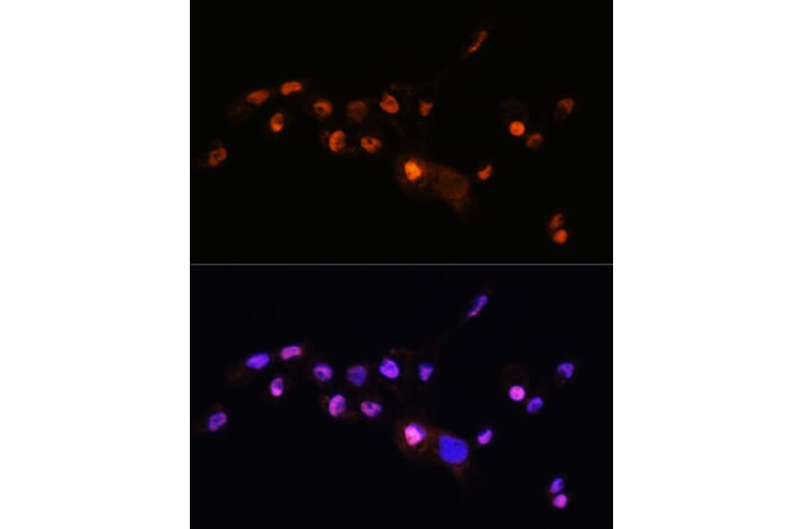 Immunofluorescence - Anti-KLF8 Antibody (A90007) - Antibodies.com