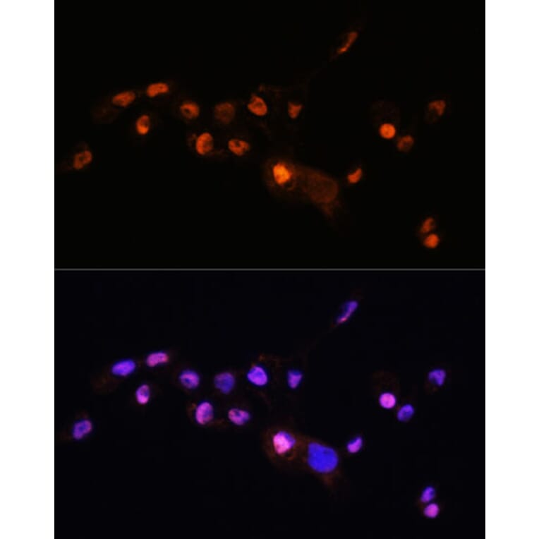 Immunofluorescence - Anti-KLF8 Antibody (A90007) - Antibodies.com