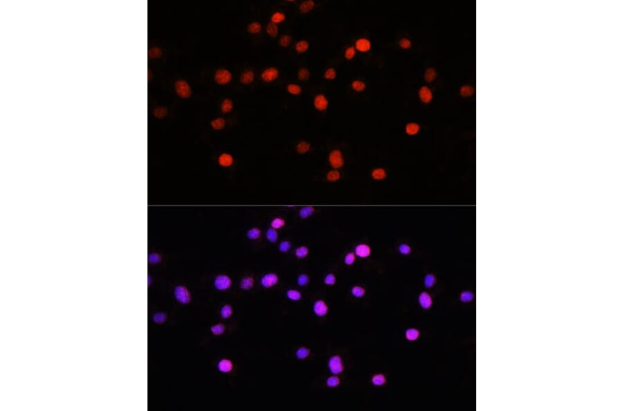 Immunofluorescence - Anti-KLF8 Antibody (A90007) - Antibodies.com
