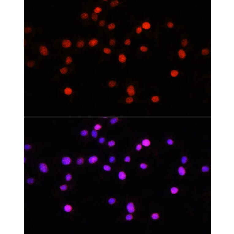 Immunofluorescence - Anti-KLF8 Antibody (A90007) - Antibodies.com