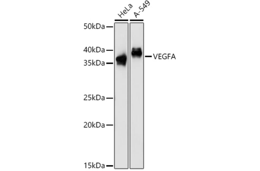 Western Blot - Anti-VEGFA Antibody (A90008) - Antibodies.com